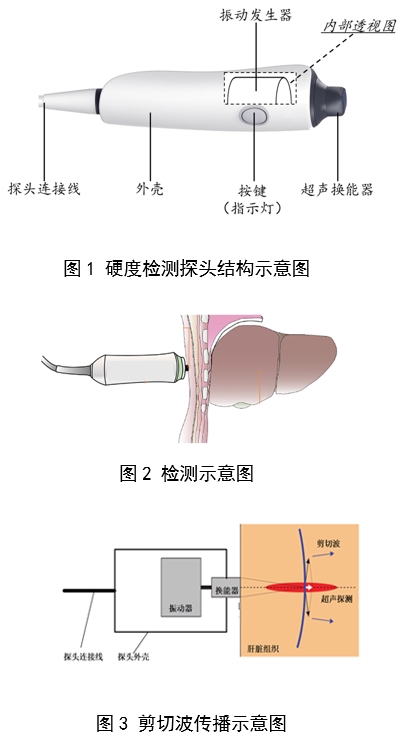定量剪切波超聲肝臟測量儀注冊審查指導原則（2023年第7號）(圖2)